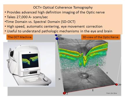 OCT= Optical Coherence Tomography
