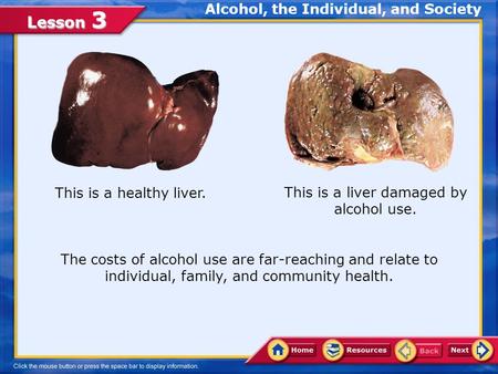 Lesson 3 This is a healthy liver. This is a liver damaged by alcohol use. The costs of alcohol use are far-reaching and relate to individual, family,