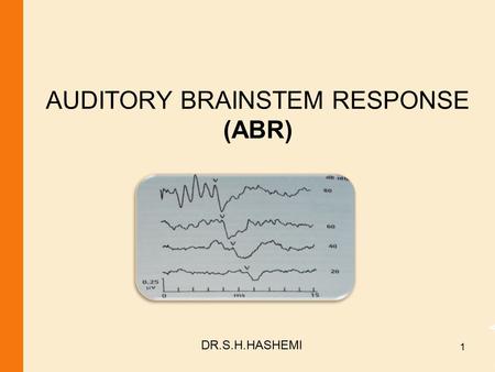 AUDITORY BRAINSTEM RESPONSE (ABR) DR.S.H.HASHEMI 1.