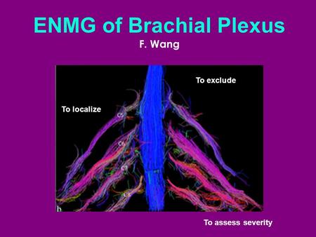 ENMG of Brachial Plexus
