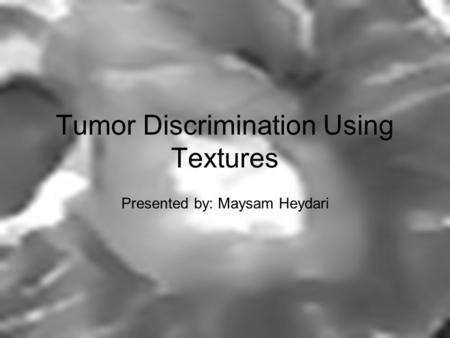 Tumor Discrimination Using Textures