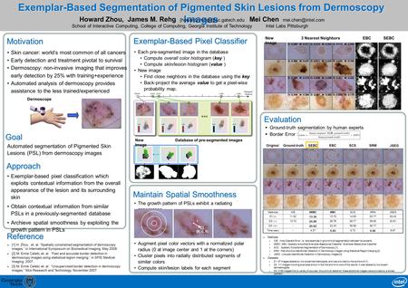 Exemplar-Based Segmentation of Pigmented Skin Lesions from Dermoscopy Images Mei Chen Intel Labs Pittsburgh Approach Motivation Skin.