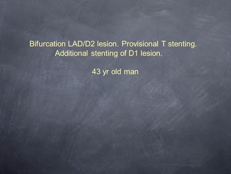 Bifurcation LAD/D2 lesion. Provisional T stenting.