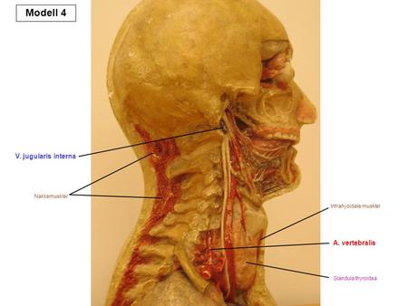Modell 4 V. jugularis interna A. vertebralis Nakkemuskler
