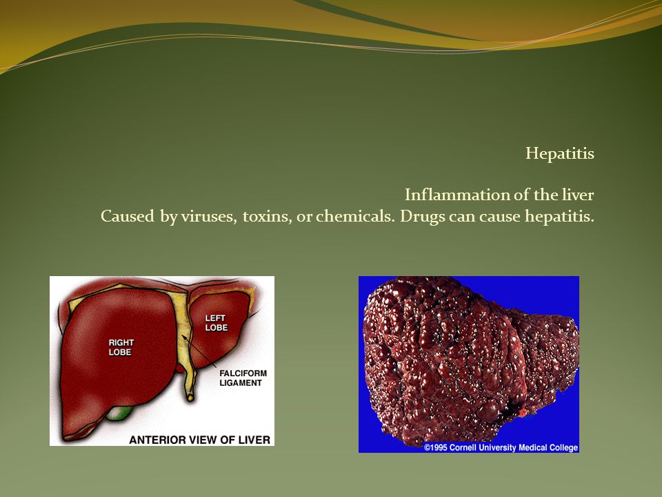 what toxins cause liver inflammation