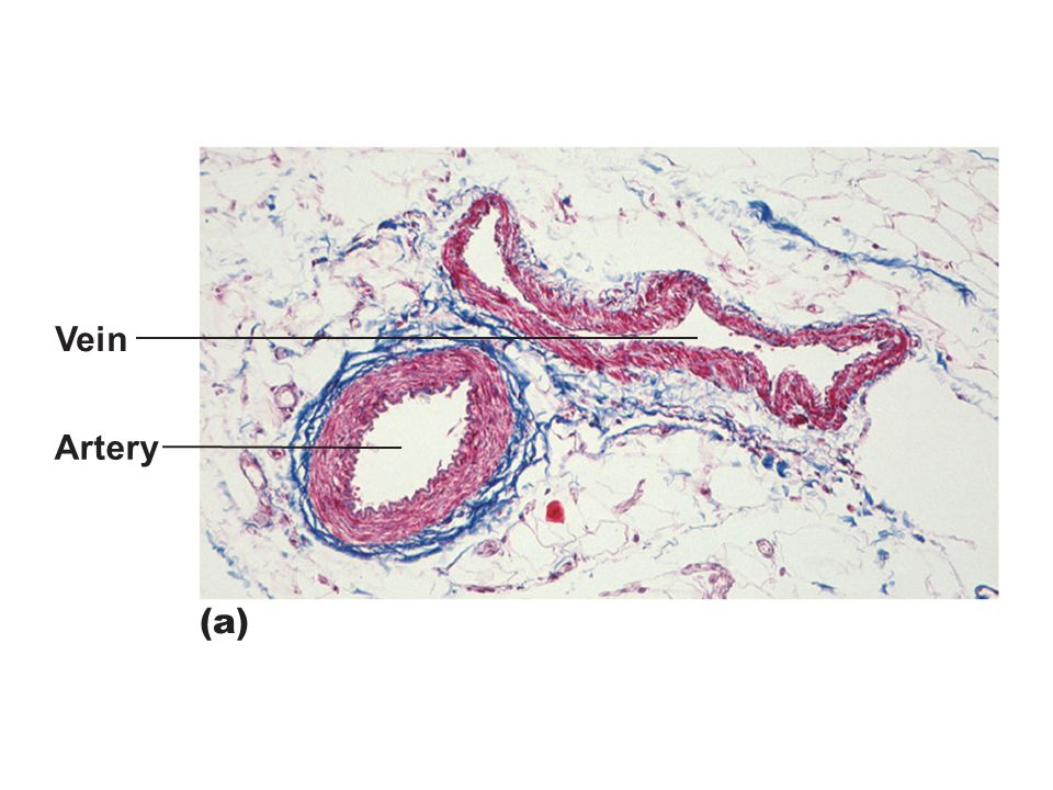 Figure 19 1a Generalized Structure Of Arteries Veins And Capillaries Artery A Ppt Video Online Download Figure 19 1a Generalized Structure Of Arteries Veins And Capillaries Artery A Ppt Video Online Download