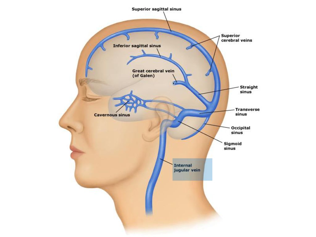 Церебрального тромбоза. Сигмовидный синус головного мозга. Сагиттальный синус головного мозга. Сигмовидный синус головного мозга анатомия. Тромбоз сигмовидного синуса на кт.