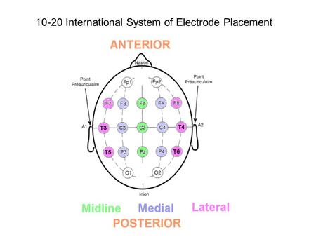 10-20 International System of Electrode Placement