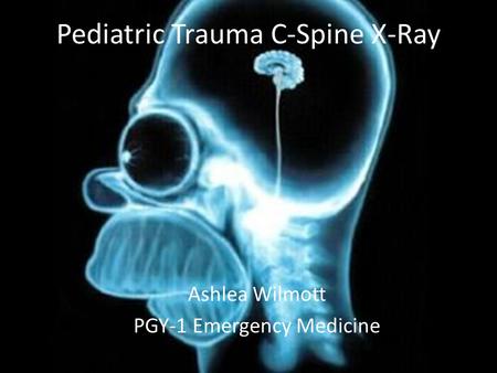 Pediatric Trauma C-Spine X-Ray Ashlea Wilmott PGY-1 Emergency Medicine.