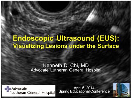 Endoscopic Ultrasound (EUS): Visualizing Lesions under the Surface Kenneth D. Chi, MD Advocate Lutheran General Hospital April 5, 2014 Spring Educational.