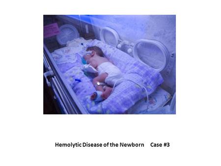 Hemolytic Disease of the Newborn Case #3