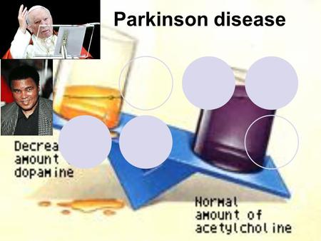 Parkinson disease.
