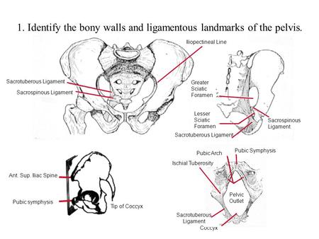 1. Identify the bony walls and ligamentous landmarks of the pelvis.