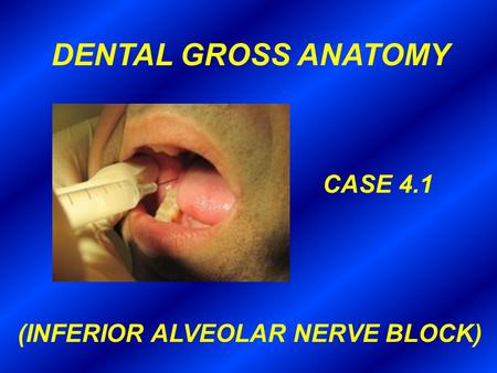 DENTAL GROSS ANATOMY CASE 4.1 (INFERIOR ALVEOLAR NERVE BLOCK)