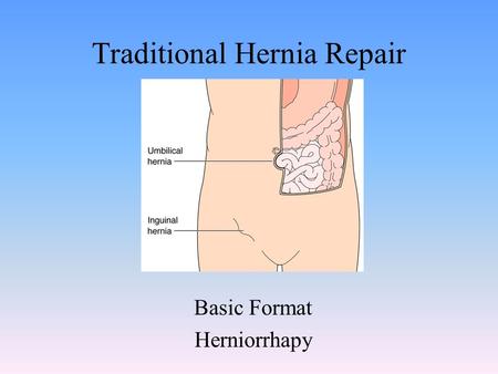 Traditional Hernia Repair