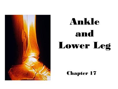 Ankle and Lower Leg Chapter 17.