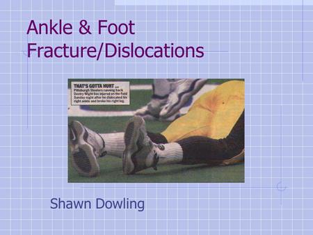 Ankle & Foot Fracture/Dislocations Shawn Dowling.