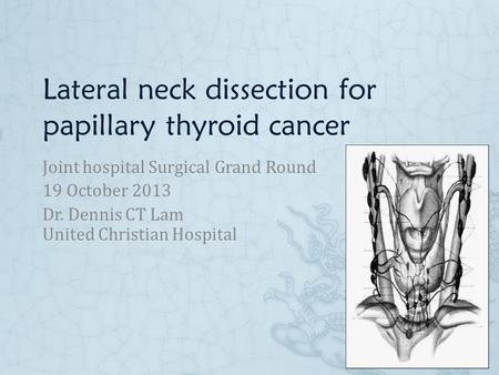Lateral neck dissection for papillary thyroid cancer