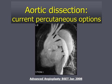 Aortic dissection: current percutaneous options Advanced Angioplasty BSET Jan 2008.