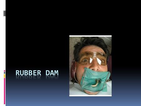 Why use a rubber dam?  Improves access and visibility of teeth  Prevents contamination of teeth and dental materials by saliva  Retracts soft tissues.