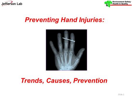 Preventing Hand Injuries: Trends, Causes, Prevention Slide 1.