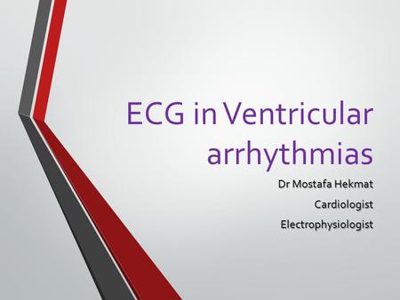 ECG in Ventricular arrhythmias