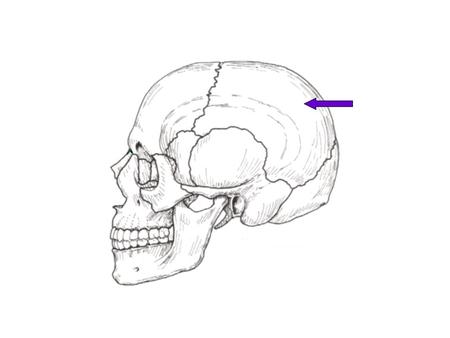 Left Parietal Bone. Left Parietal Bone Frontal Bone.