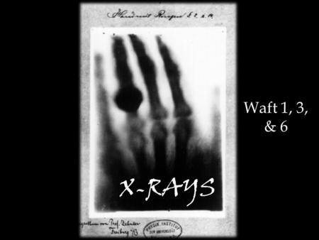 X-RAYS Waft 1, 3, & 6. On a fine day in Germany in 1895… His first experiment with human tissue involved a test subject (his lovely wife Bertha) and her.