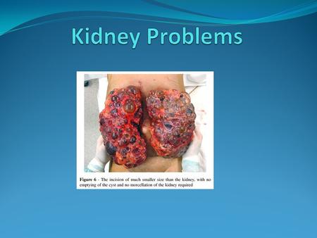 Kidney Problems.