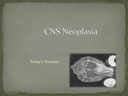 CNS Neoplasia Today’s Frontier.