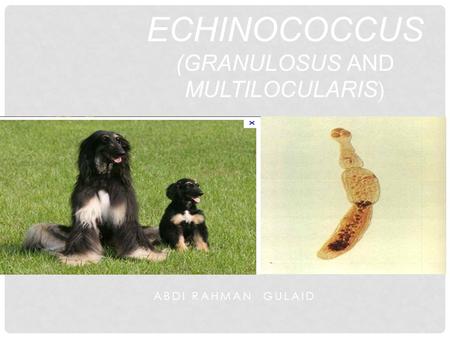 ABDI RAHMAN GULAID ECHINOCOCCUS (GRANULOSUS AND MULTILOCULARIS )