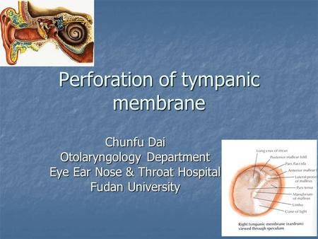 Perforation of tympanic membrane Chunfu Dai Otolaryngology Department Eye Ear Nose & Throat Hospital Fudan University.