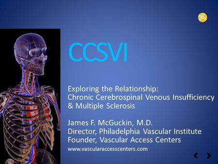 CCSVI Exploring the Relationship: