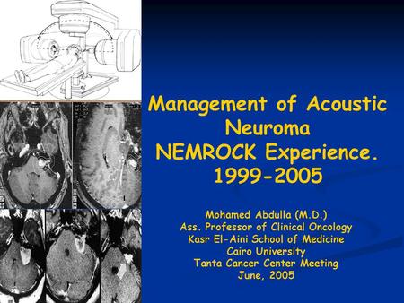 Management of Acoustic Neuroma NEMROCK Experience. 1999-2005 Mohamed Abdulla (M.D.) Ass. Professor of Clinical Oncology Kasr El-Aini School of Medicine.