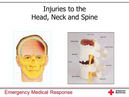 Emergency Medical Response Injuries to the Head, Neck and Spine.