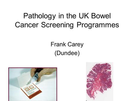 Pathology in the UK Bowel Cancer Screening Programmes Frank Carey (Dundee)