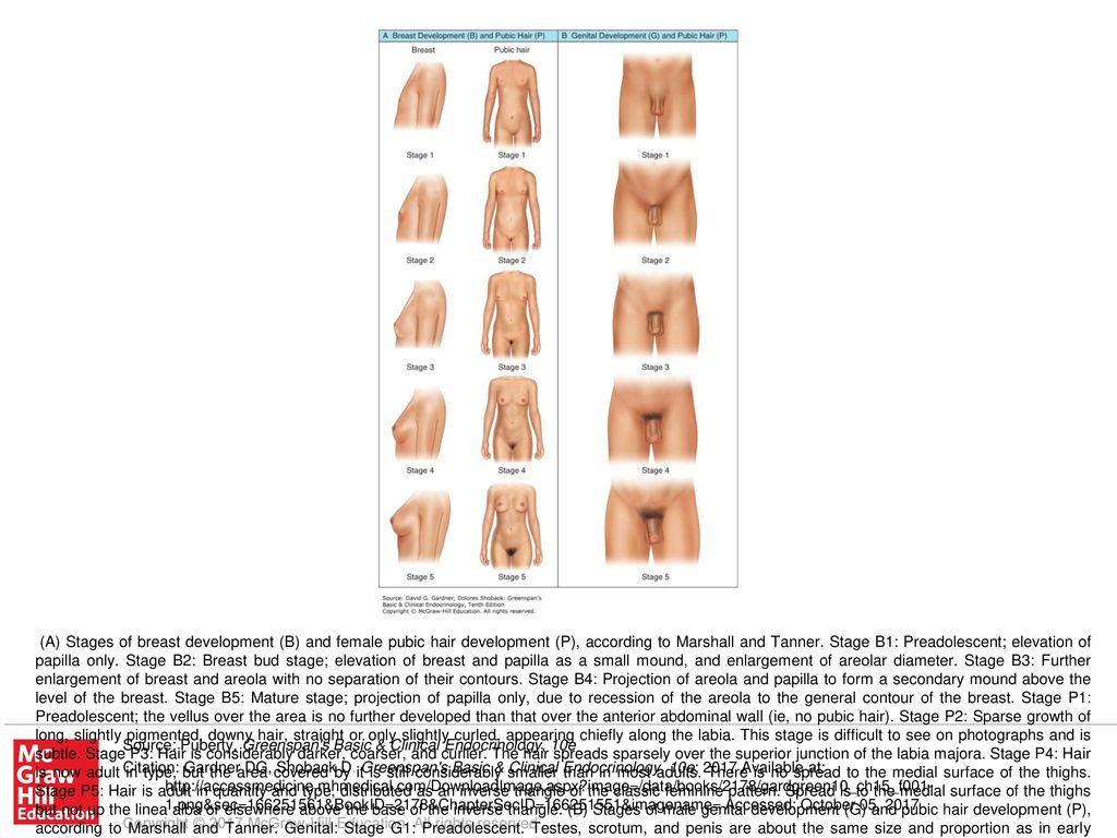 A) Stages of breast development (B) and female pubic hair development (P),  according to Marshall and Tanner. Stage B1: Preadolescent; elevation of  papilla. - ppt download