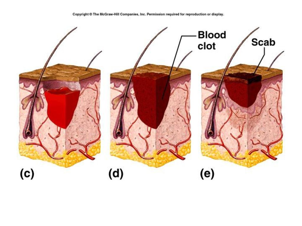 The Integumentary System - ppt download