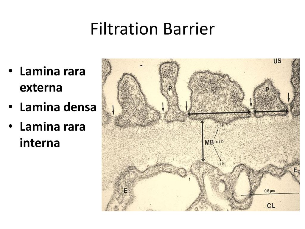 Filtration Barrier Lamina rara externa Lamina densa - ppt download