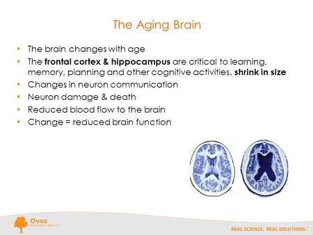 The Aging Brain The brain changes with age The frontal cortex & hippocampus are critical to learning, memory, planning and other cognitive activities,
