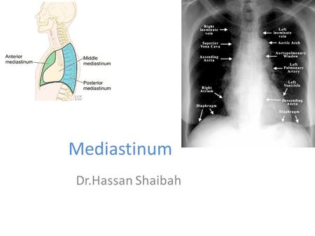 Mediastinum Dr.Hassan Shaibah.