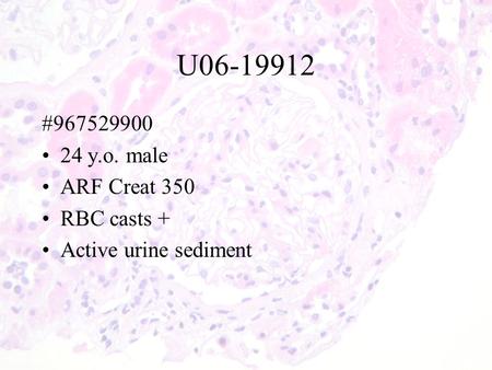 U06-19912 #967529900 24 y.o. male ARF Creat 350 RBC casts + Active urine sediment.