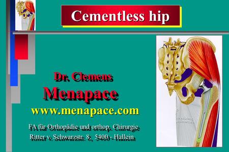 Cementless hip Cementless hip Dr. Clemens Menapace Dr. Clemens Menapace FA für Orthopädie und orthop. Chirurgie FA für Orthopädie und orthop. Chirurgie.