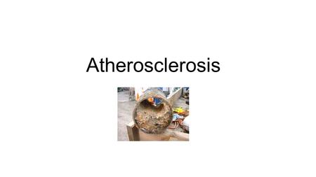 ATHEROSCLEROSIS. - ppt video online download