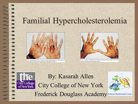 Familial Hypercholesterolemia By: Kasarah Allen City College of New York Frederick Douglass Academy.