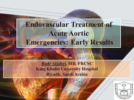 Endovascular Treatment of Acute Aortic Emergencies: Early Results Badr Aljabri, MD, FRCSC King Khalid University Hospital Riyadh, Saudi Arabia.