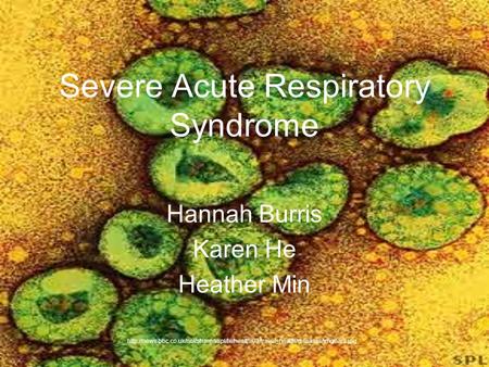 Severe Acute Respiratory Syndrome Hannah Burris Karen He Heather Min