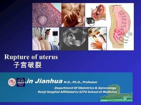 Rupture of uterus 子宫破裂 Lin Jianhua M.D., Ph.D., Professor Department Of Obstetrics & Gynecology Renji Hospital Affiliated to SJTU School of Medicine.