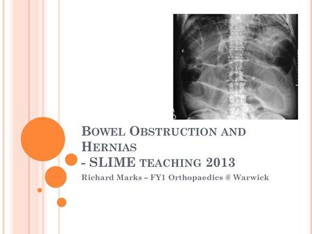B OWEL O BSTRUCTION AND H ERNIAS - SLIME TEACHING 2013 Richard Marks – FY1 Warwick.