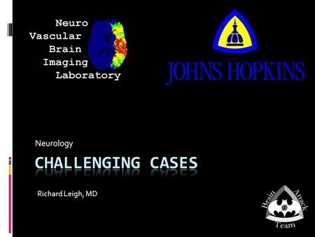 Neurology Richard Leigh, MD. Post Partum Headache I  34 y/o healthy woman 3 days post partum after an uncomplicated delivery with epidural anesthesia.